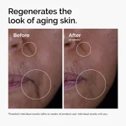 The Ordinary GF 15% solution