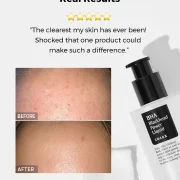 Cosrx Bha Blackhead Power Liquid