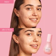Glow Recipe  Watermelon Glow Niacinamide Dew Drops Serum