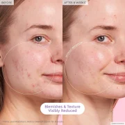 Glow Recipe  Glass Skin Hydration Kit