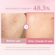 MEDICUBE PDRN Pink Niacinamide Milky Toner 150 ML