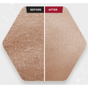 SKIN 1004 ZOMBIE BEAUTY Bloody Peel