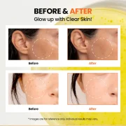 K-SECRET SEOUL 1988 GLOW SERUM NIACINAMIDE 15% + YUJA