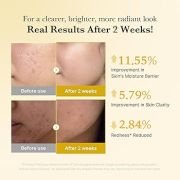 Medicube Kojic Acid Tumeric Vita Capsule Cream