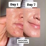 DR. ALTHEA 345 RELIEF CREAM