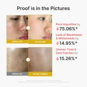 Medicube Kojic Tumeric Peel Shot