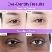 Numbuzin No.9 NAD+ Collagen Under Eye Patches (5 Pairs)