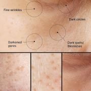 Celimax Pore + Dark Spot Brightening Cream